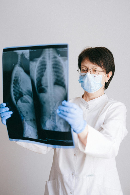 X-ray of lungs