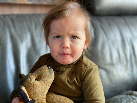 Hand, Foot, and Mouth Disease (HFMD): Symptoms, Care, and Relief