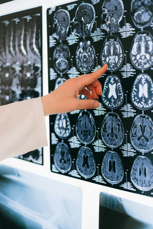 Facing MS Together: Support, Science, & Self-Care